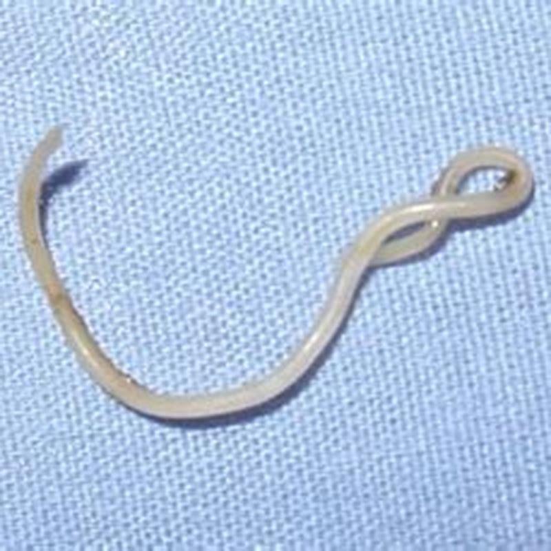 can-roundworms-be-passed-from-cat-to-cat-diy-seattle