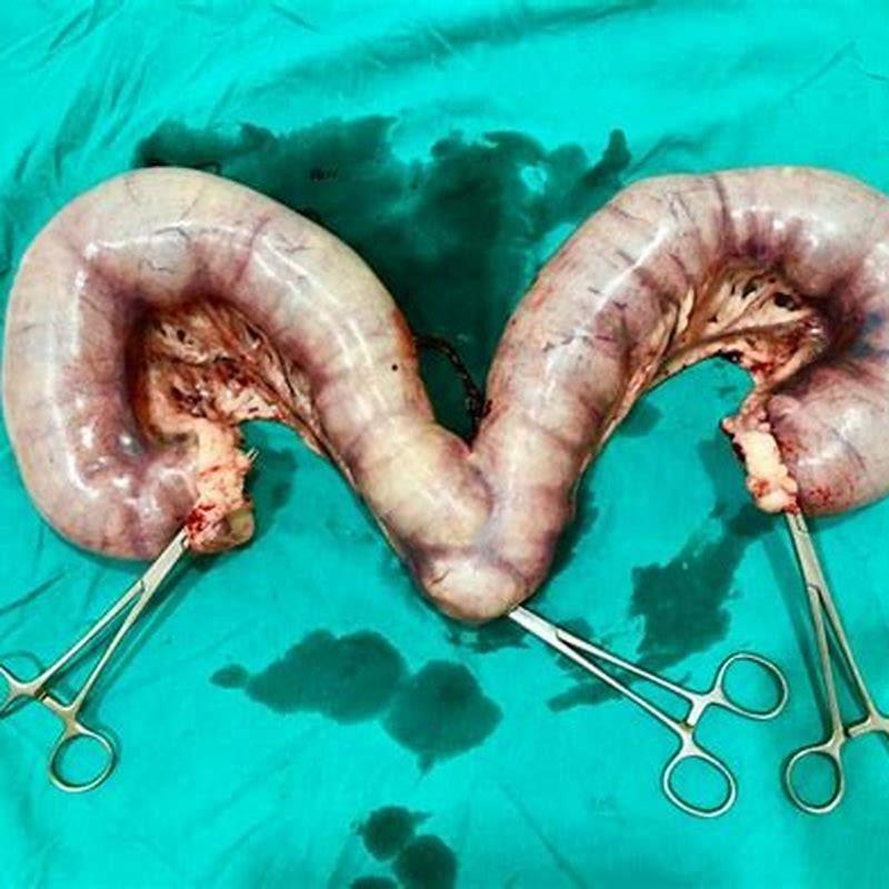 What are the symptoms of pyometra in a cat?