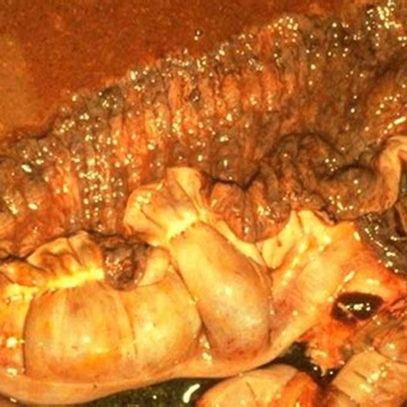 What causes inflammatory bowel disease in horses?