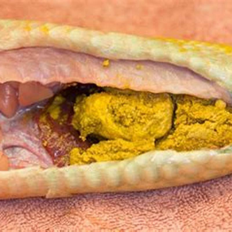 What is snake impaction?